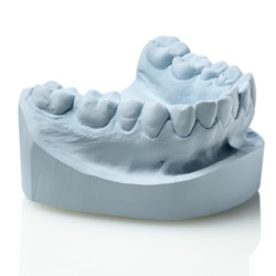 Gips Elite Model Fast 3kg,...